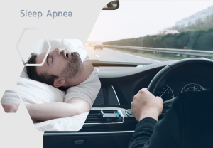 0.2 _Sleep Apnea